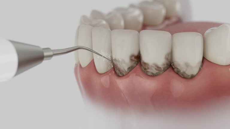 Trusted Teeth Cleaning And Checkup service in Cornwall, PA - Dentist Open Now